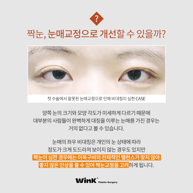 짝눈, 눈매교정으로 개선할 수 있을까? 윙크성형외과 눈매교정으로 가능해! 관련 이미지 2