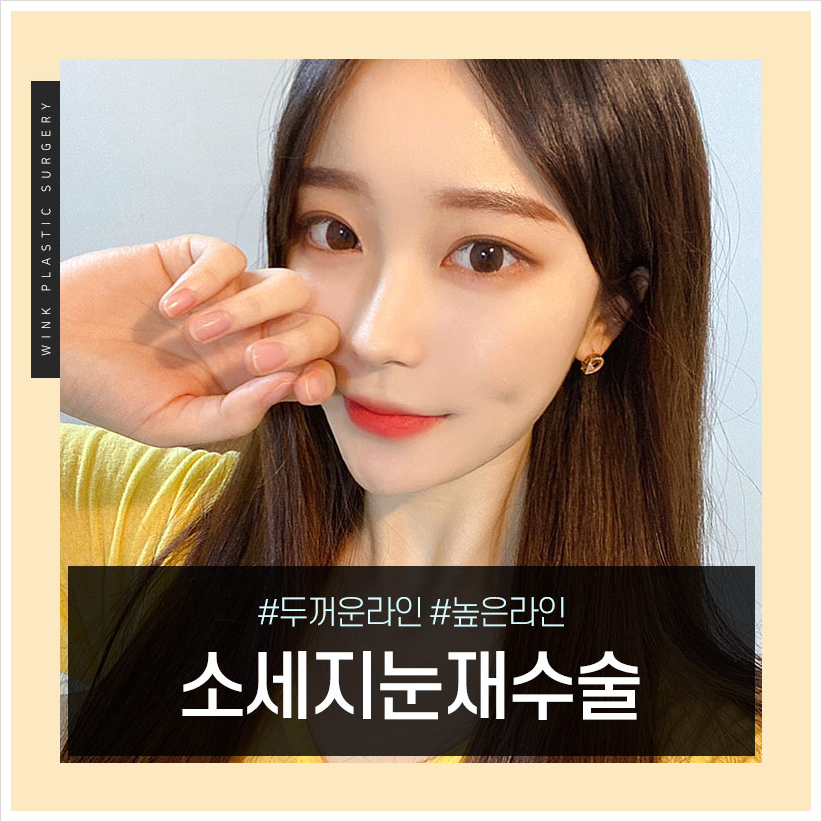 Sausage Eyes After Double Eyelid Surgery: If You’re Concerned About a Bulky Double Eyelid, Wink Plastic Surgery’s Double Eyelid Line Lowering and Sausage Eye Revision Surgery Costs image 1