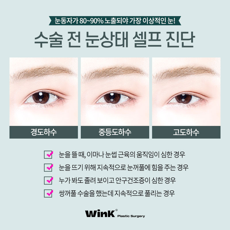 Sinsa Station Eye Correction Review | Sinsa Eye Correction Specialist | Wink Plastic Surgery | Non-Incisional Eye Correction image 3