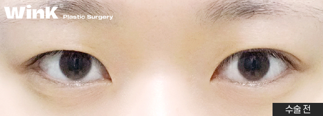 A Natural, Smooth Curved Line That Suits My Eyes! image 3