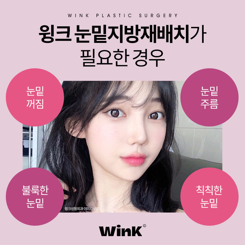 윙크성형외과 눈밑지방재배치로 생기 가득한 환한 눈밑으로 관련 이미지 5