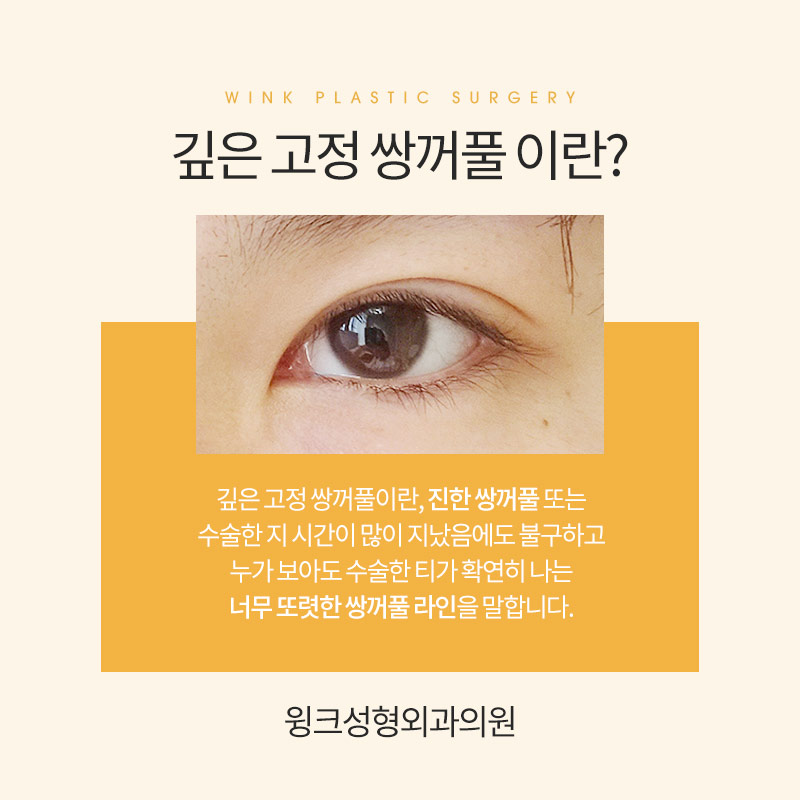 How Do You Release Deep Double Eyelid Fixation? image 2