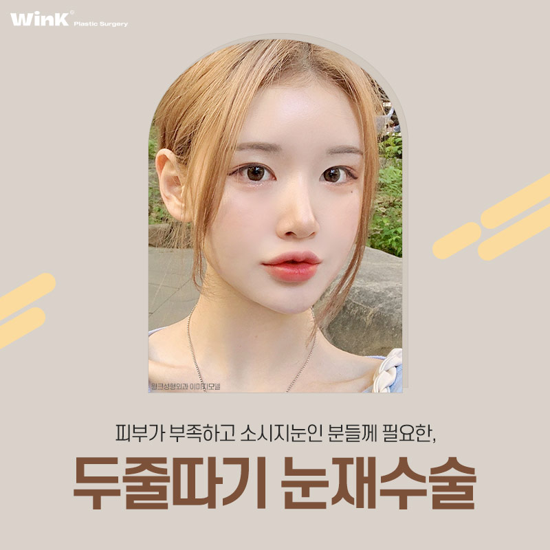 두줄따기로 라인 낮추기 하고 나서 흉터는 어떨까? 관련 이미지 1