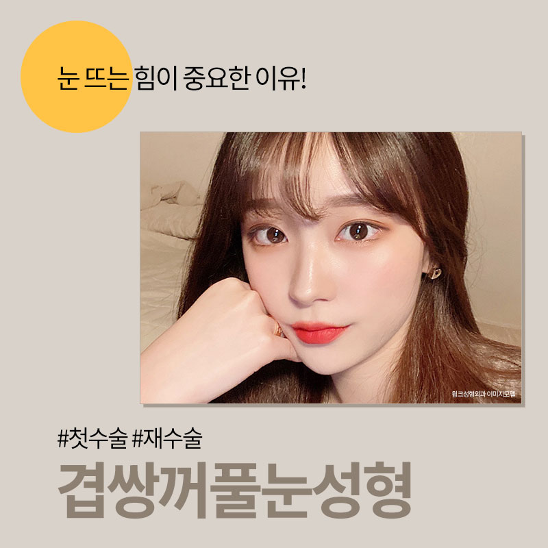 윙크성형외과에서 알려드리는 겹쌍꺼풀과 눈 뜨는 힘이 중요한 이유! 관련 이미지 1