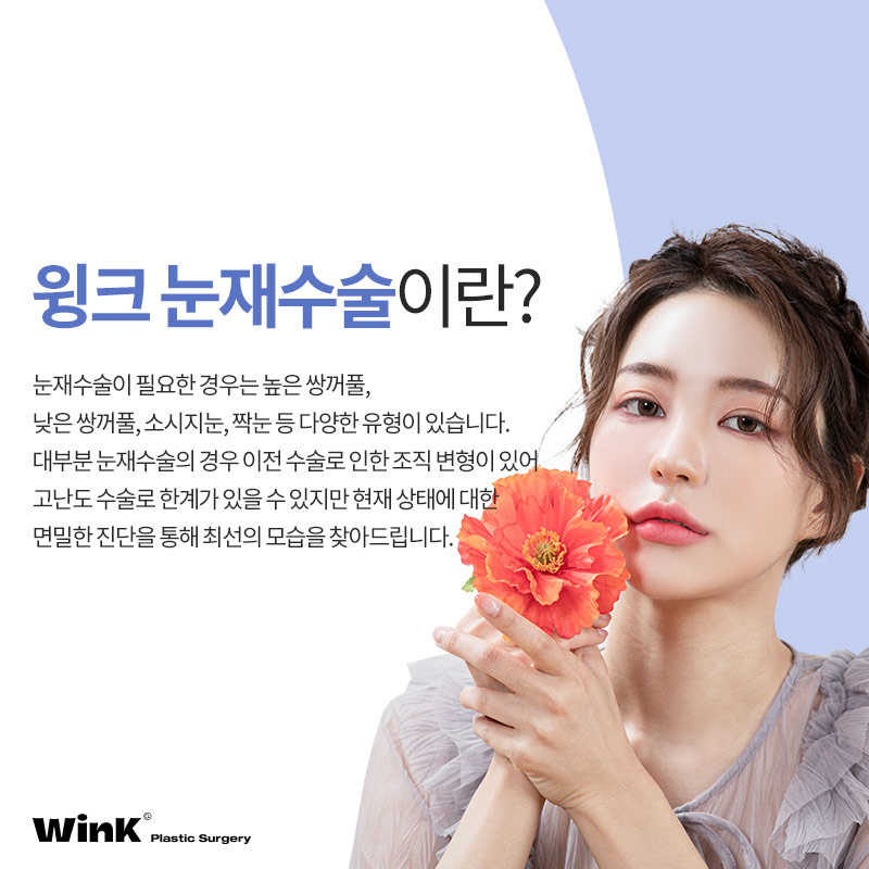 Looking for a place that does double eyelid revision surgery well? Wink Plastic Surgery eye revision surgery review image 2