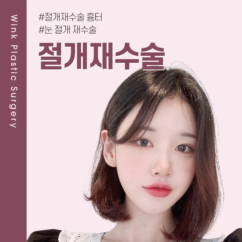 절개 쌍꺼풀 흉터에 대해 알아보겠습니다. 관련 이미지 1