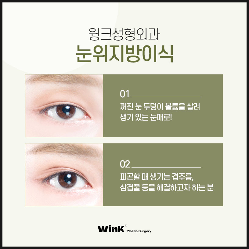 Sunken Upper-Eyelid Fat Graft Price | Wink Plastic Surgery | Eyelid Fat Grafting | Sunken Eyelid Surgery | Sinsa Upper-Eyelid Fat Graft Review image 3