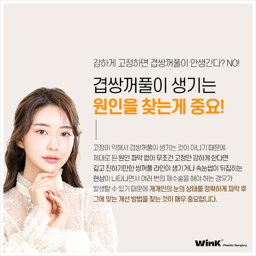 Multiple Eyelids, Double Eyelid Creases, Double Folded Eyelids, Eyelid Creases, Wink Plastic Surgery, Double Eyelids, Double Eyelid Revision Cost image 4