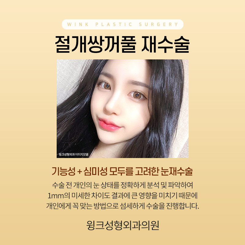 절개 쌍수 재수술에 대해 알아보겠습니다. 관련 이미지 2