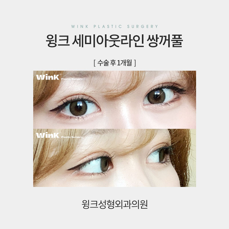 세미아웃 연예인 누가 있을까? 관련 이미지 9