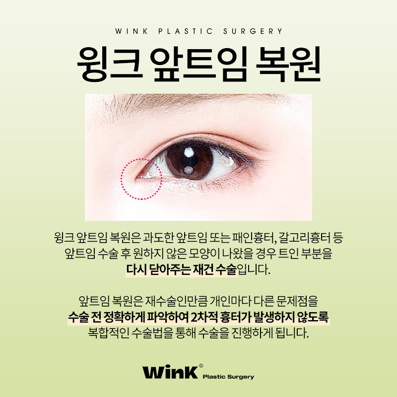 미세한 차이로 달라진 인상, 신사앞트임복원수술로 시원한 눈매로 관련 이미지 2