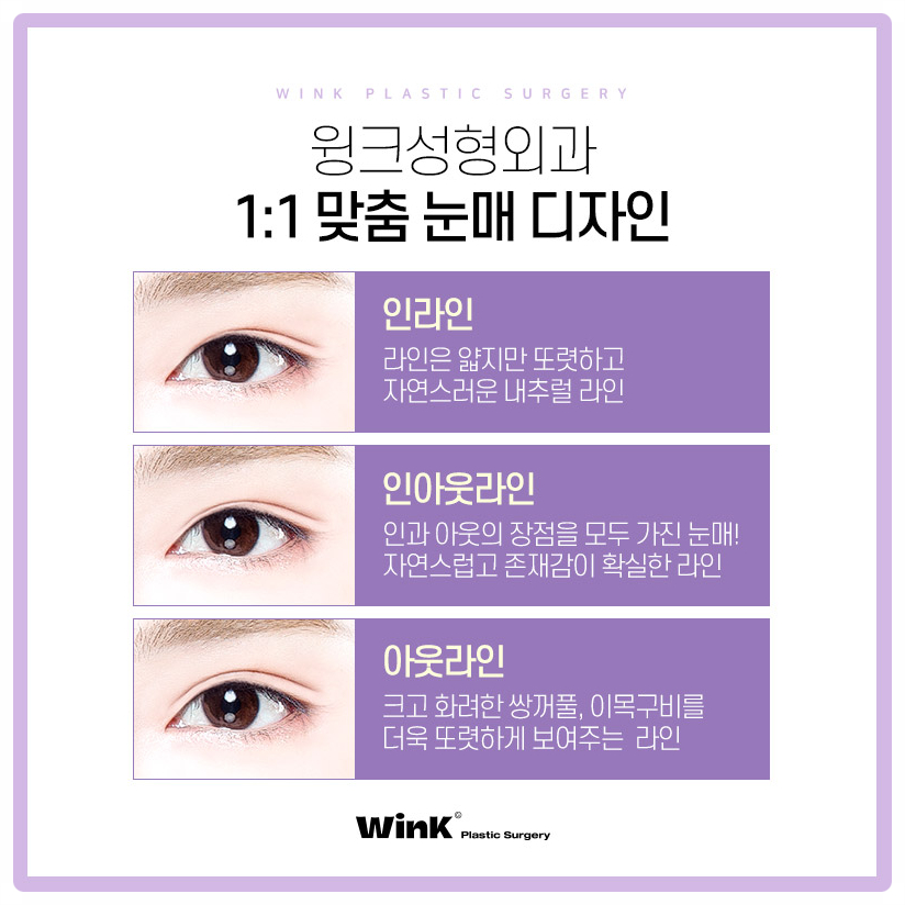 자연유착쌍꺼풀후기 자연유착법 윙크성형외과 자연유착쌍꺼풀비용 관련 이미지 5