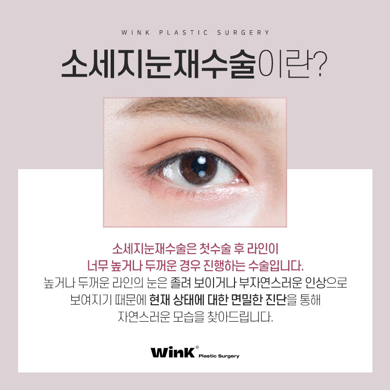 두껍고 높은 소세지눈? 윙크성형외과 두줄따기 눈재수술로 개선 관련 이미지 2