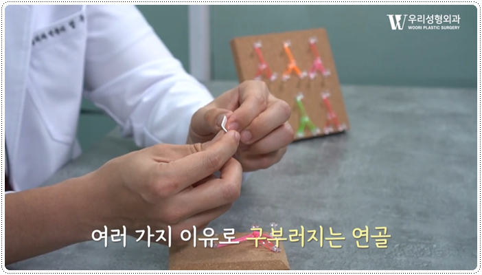 코수술 구축 발생 원인은? 관련 이미지 4