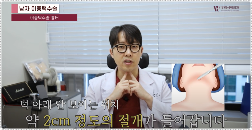 이중턱살 확실히 없애는 방법 관련 이미지 3