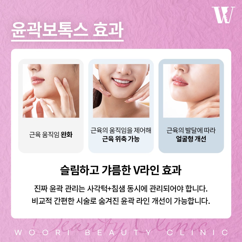 사각턱보톡스 턱선은 어떻게 달라질까 관련 이미지 3