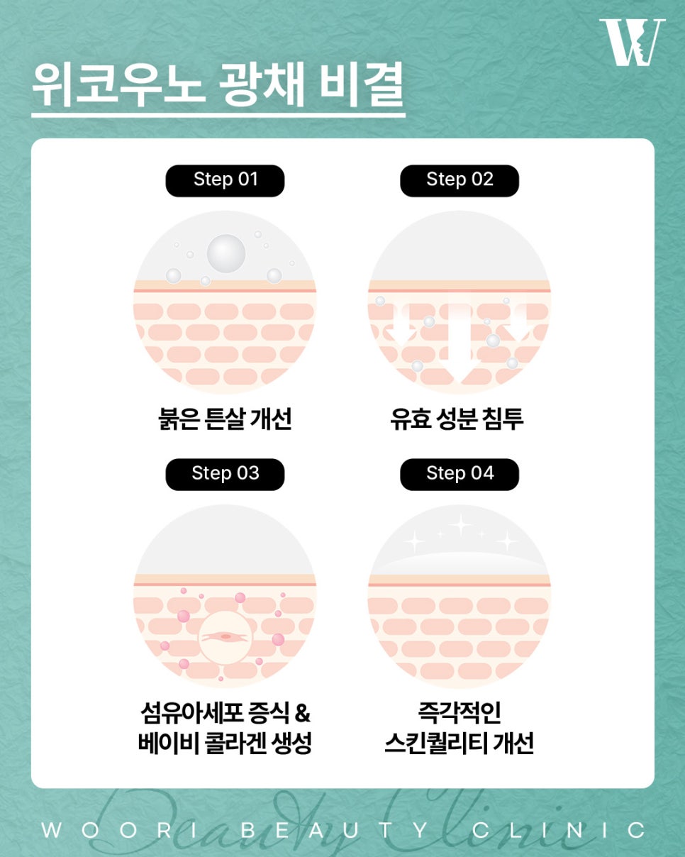 위코우노 피부가 푸석하고 건조해 보인다면 관련 이미지 3