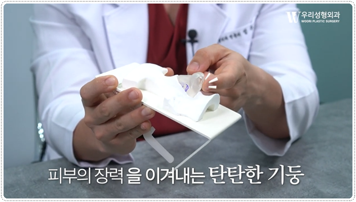 코수술 구축 발생 원인은? 관련 이미지 3