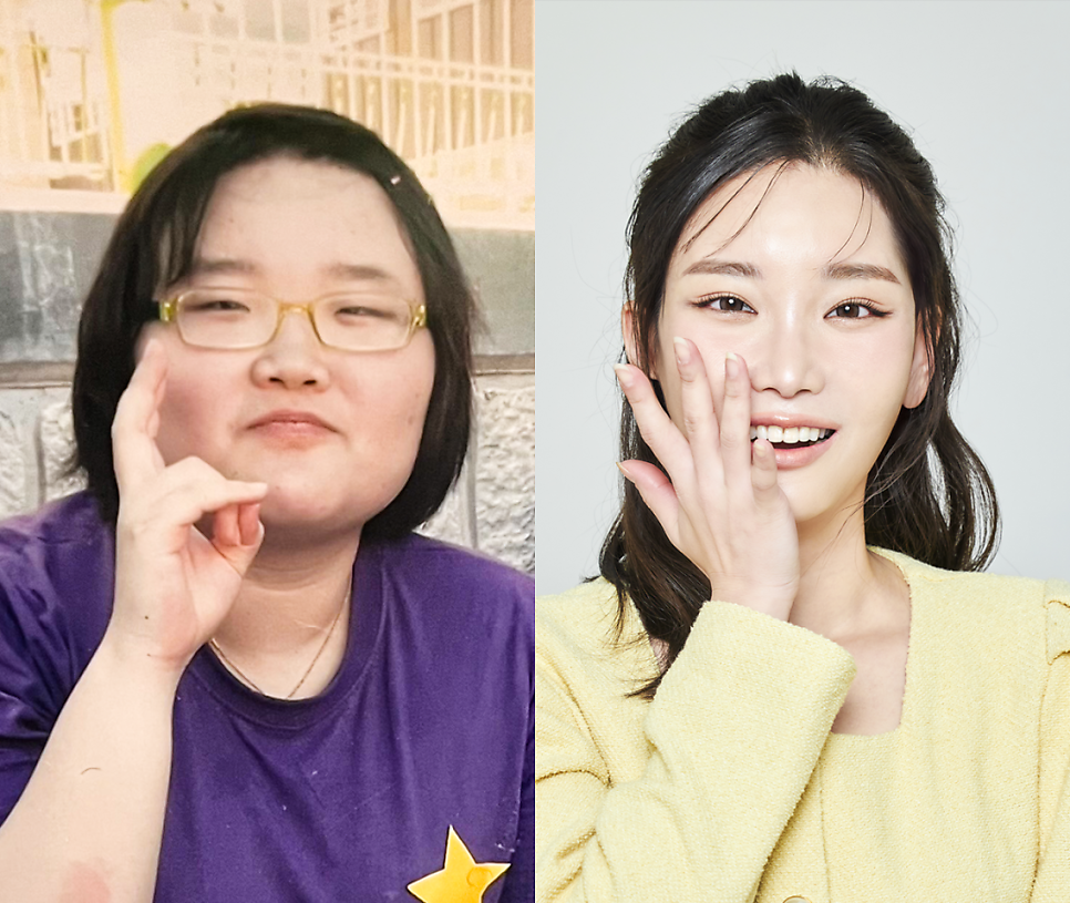 우리성형외과 X 맥미걸 메이크오버 프로젝트 첫 방영 관련 이미지 13