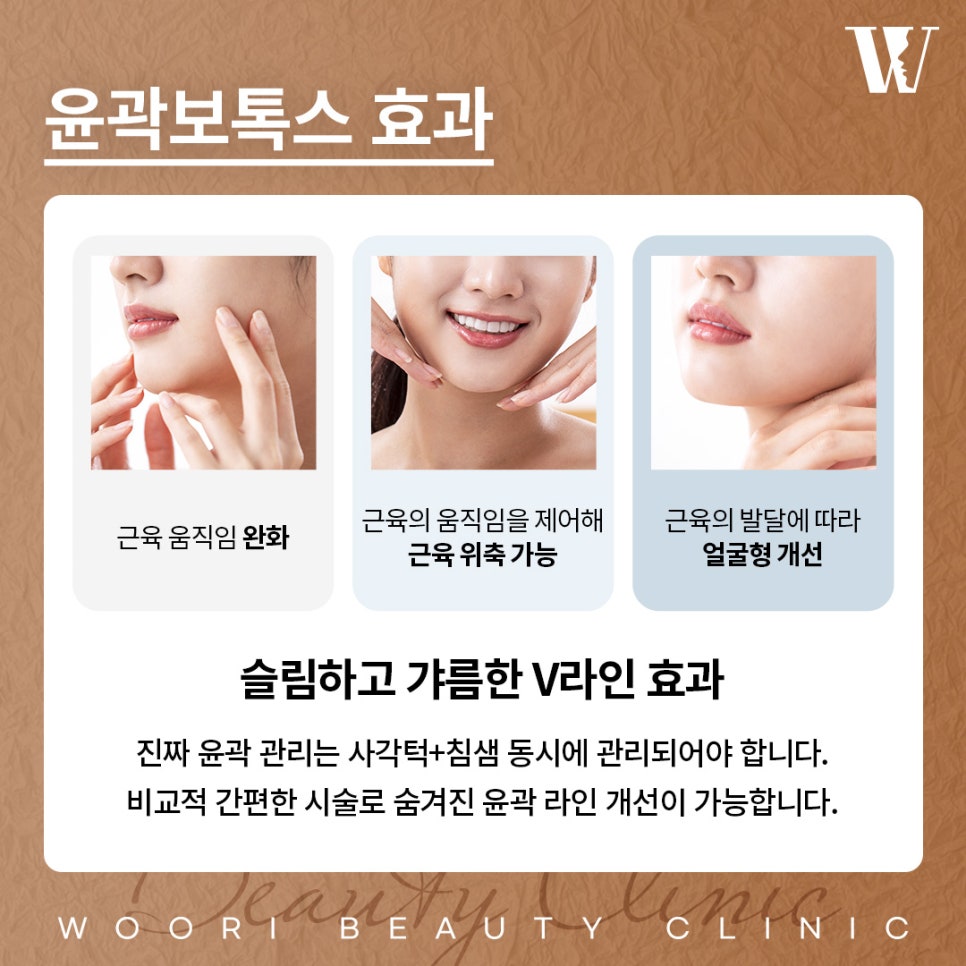 사각턱보톡스 효과 얼마나 달라질 수 있을까? 관련 이미지 3