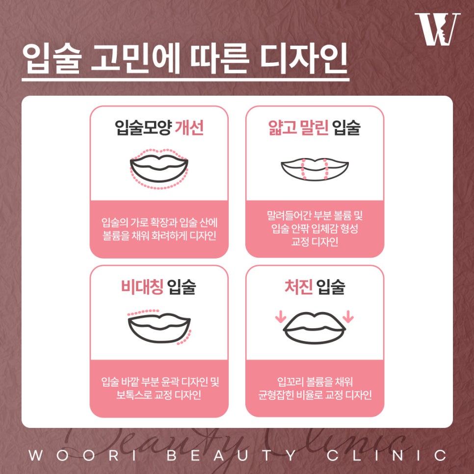 자연스러운 입술필러 조건 알아보자 관련 이미지 4