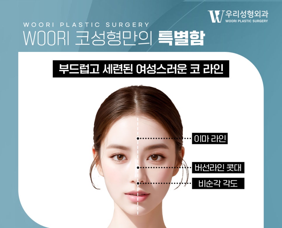 복코 개선 인상이 달라보이는 이유 관련 이미지 2