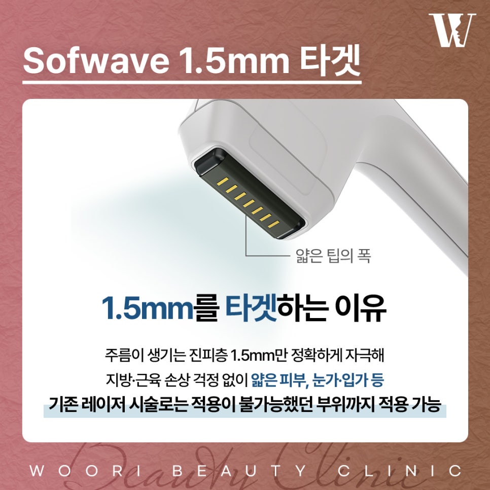 소프웨이브가격 추천하는 유형 알아보자 관련 이미지 4