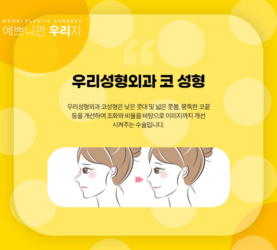 코성형 후 붓기 , 부작용 , 염증 치료를 위한 코성형 후기 관련 이미지 3