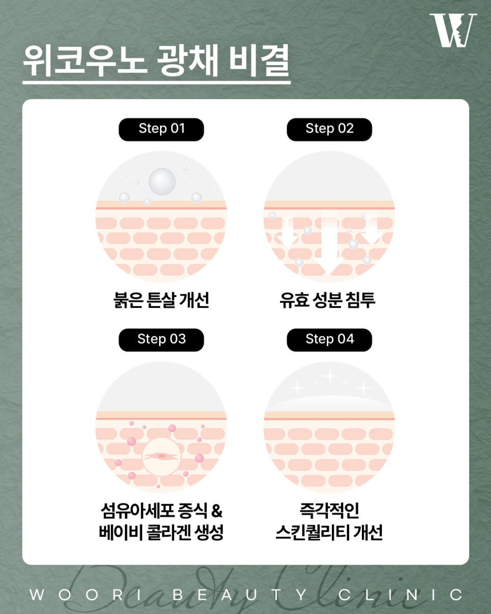 위코우노 이런 피부 고민이라면 추천드립니다 관련 이미지 4