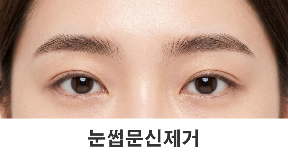 눈썹문신제거 한 번의 레이저로 지울 수 있을까요? 관련 이미지 1
