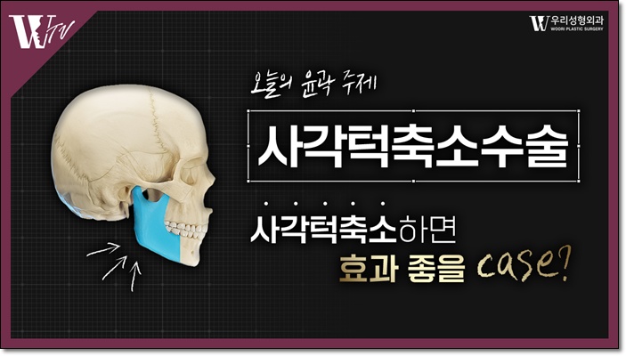 사각턱축소술 수술 방법 알아보자 관련 이미지 1