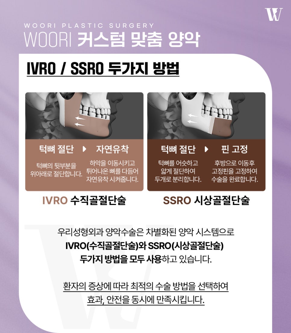 양악수술후기 주걱턱 돌출입 비대칭 케이스별 변화! 관련 이미지 3
