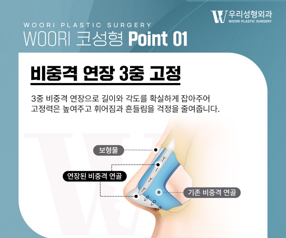 복코 개선 인상이 달라보이는 이유 관련 이미지 3