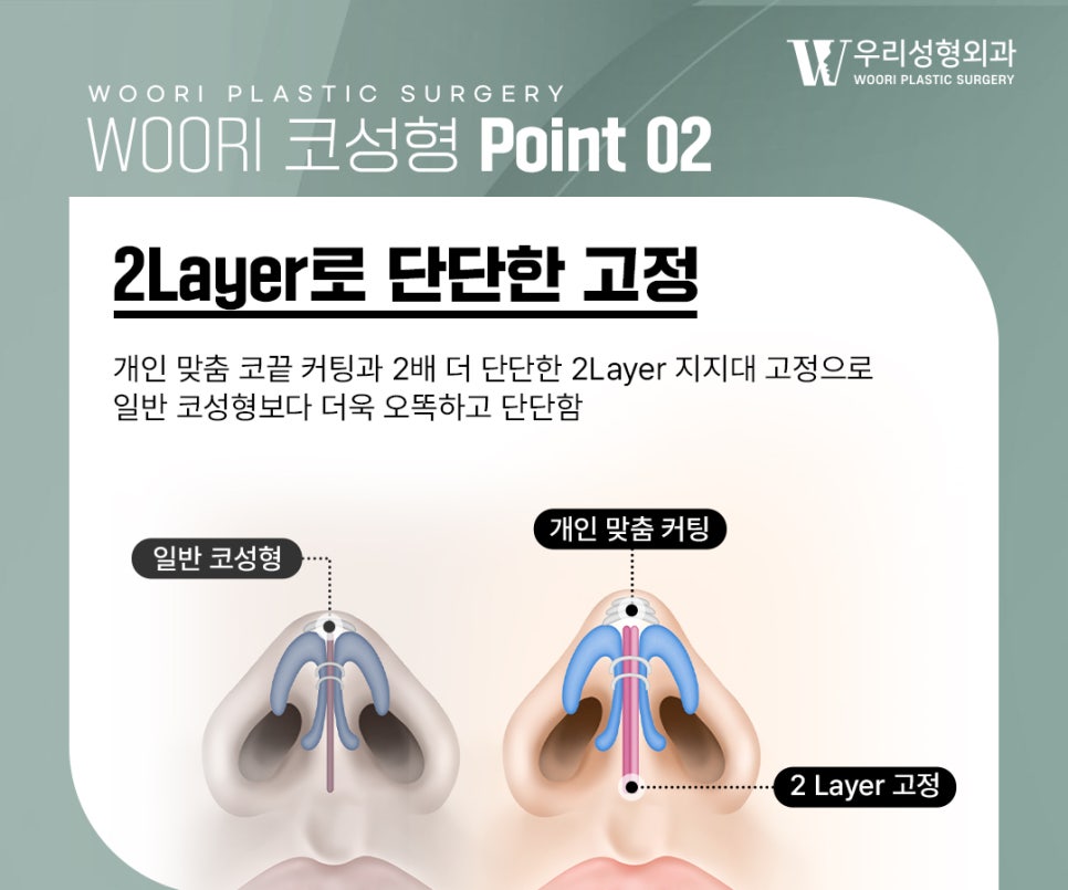 코수술비용 코끝을 안정적으로 디자인하는 과정 관련 이미지 3
