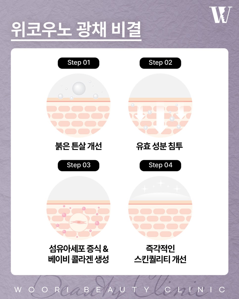 위코우노 시술로 피부 재생과 톤 개선을 관련 이미지 4
