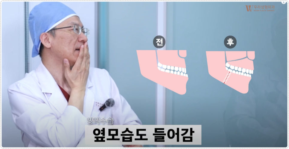앙약수술과정 함께 살펴봅시다 관련 이미지 3