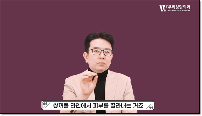 상안검수술 어떻게 진행되나요? 관련 이미지 2
