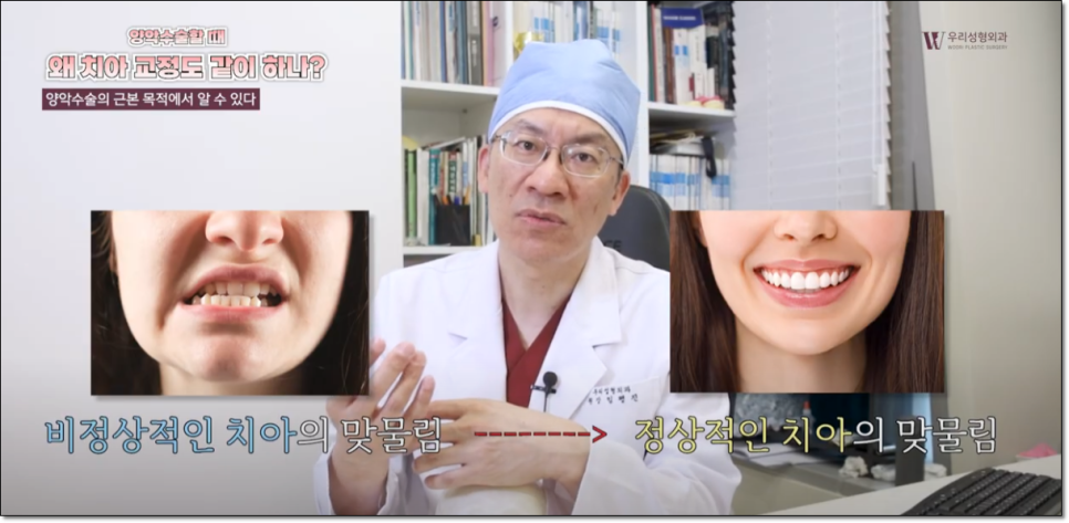 양악시술 치아교정이 필요하나요? 관련 이미지 2