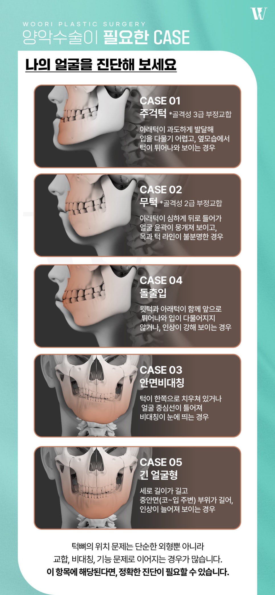 양악수술 안면윤곽과 무엇이 다를까? 관련 이미지 5