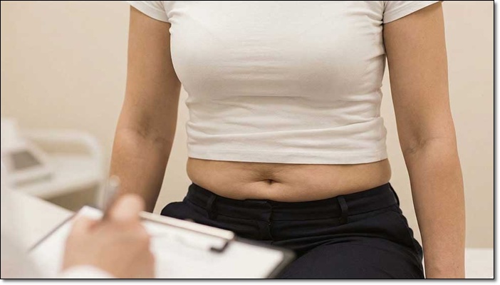 복부거상술 미니복부거상 차이 정리 관련 이미지 5