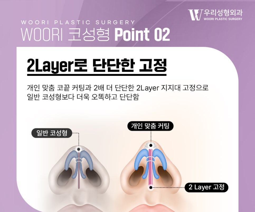 코재수술 시 확인하는 코끝 구조와 비순각 관련 이미지 3