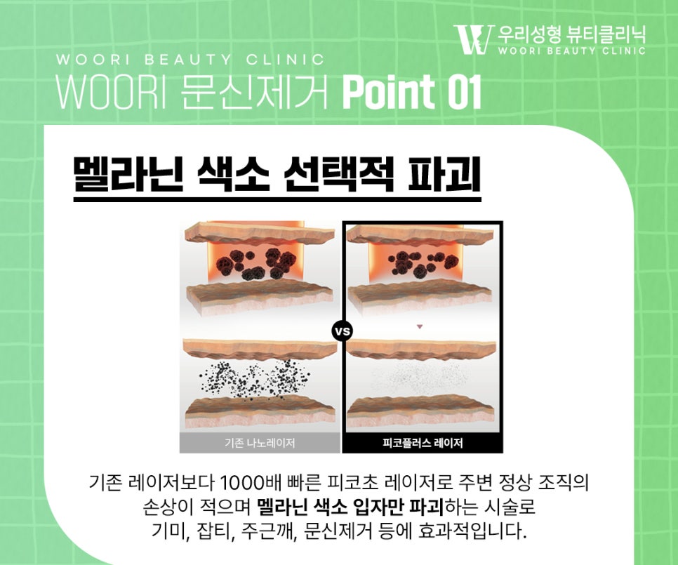눈썹문신제거 한 번의 레이저로 지울 수 있을까요? 관련 이미지 3