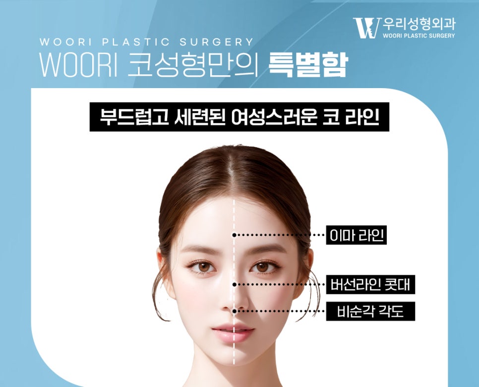 코성형 비중격과 비순각까지 고려해야 하는 이유 관련 이미지 2