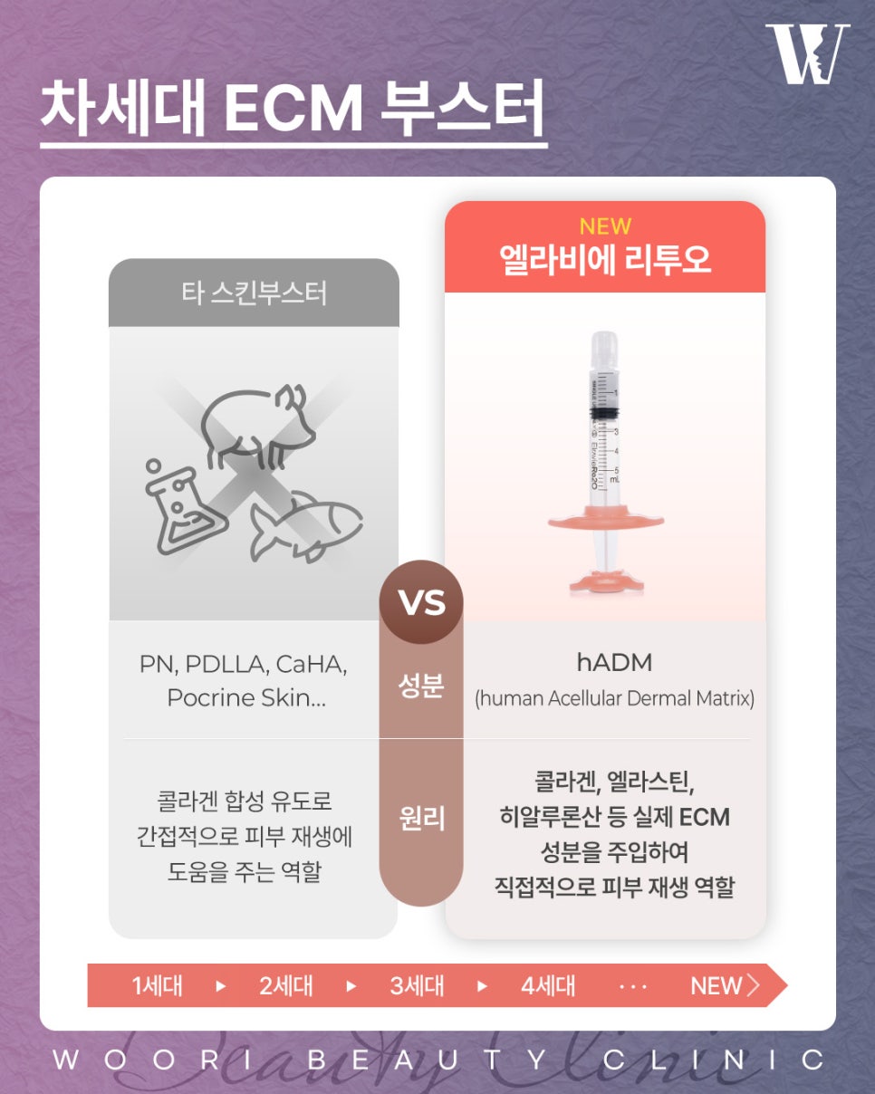 엘라비에리투오 효과 총정리! 관련 이미지 5