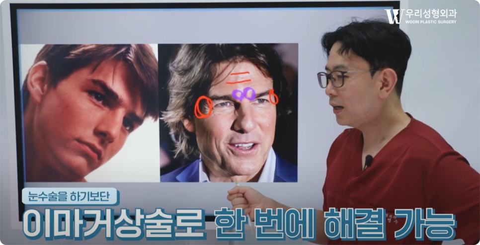 이마거상 비용 사용해야될까 관련 이미지 3