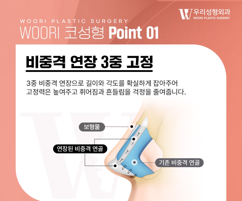 코성형결과 자연스러운 옆라인을 만드는 기준 관련 이미지 2