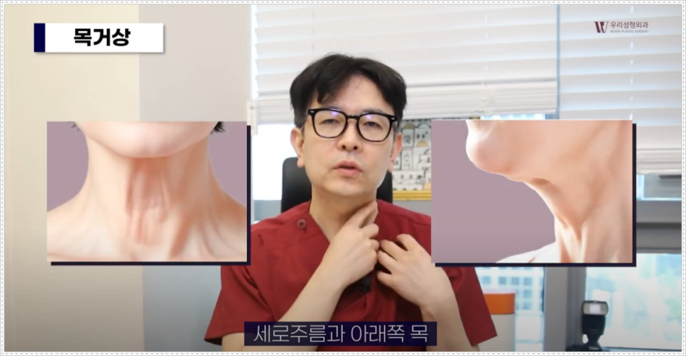 안면거상술 효과 잘 보려면? 관련 이미지 4