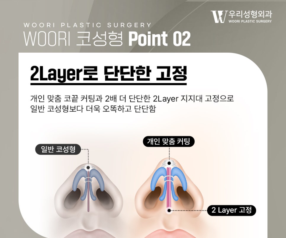 Nasal Bridge Height in Rhinoplasty: Nasal Proportions Are Not Defined by Height Alone image 3