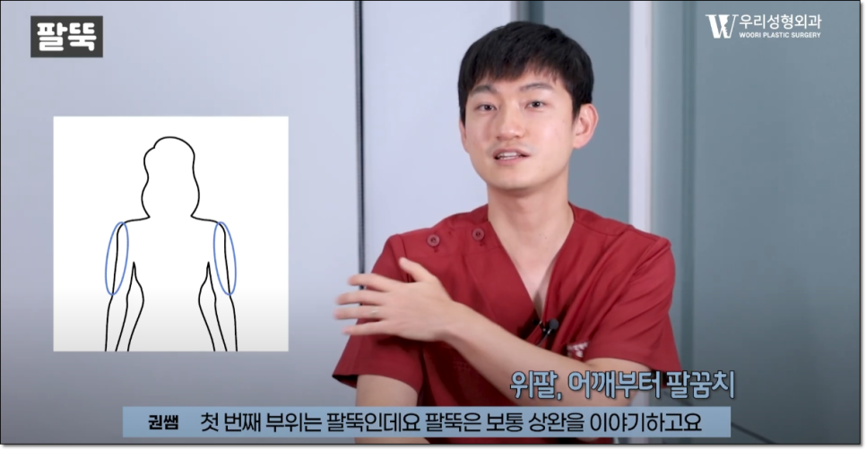 상체지방흡입 효과 한눈에 알아보기 관련 이미지 2