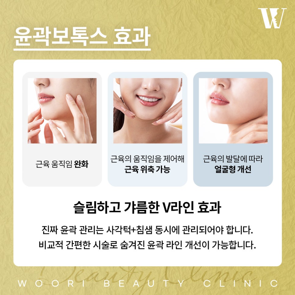 사각보톡스 효과와 유지기간 알아보기 관련 이미지 3
